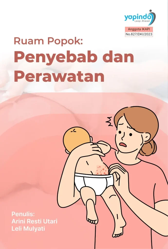 Jangan Tunggu Parah! Fakta Penting tentang Ruam Popok yang Sering Diabaikan Orang Tua