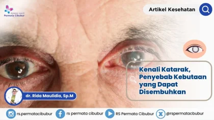 Kemenkes: Kebutaan Akibat Katarak Capai 650.000 Orang pada 2025
