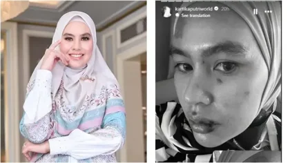 Ramalan Ki Atmo Ungkap Misteri Artis: Dari Insiden Jalanan Hingga Penyakit Misterius