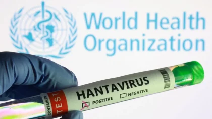 3 Orang di Jakarta Positif Hantavirus, 6 Lainnya Masih Suspek