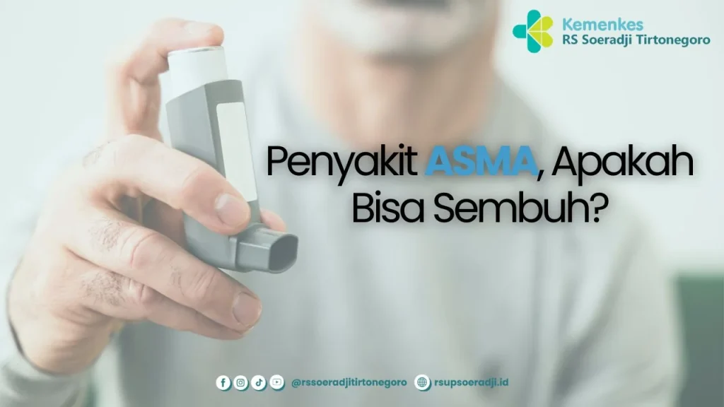 Asma Bisa Dikendalikan: Dokter Ungkap Cara Efektif Mengatasi Penyakit Paru