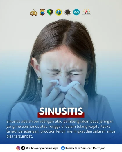 Pilek Tak Sembuh Lebih dari 10 Hari? Waspada Gejala Gangguan Sinus