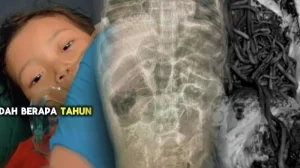 Balita di Bantul Meninggal Akibat Disuntik Penenang dan CT Scan di RSUD