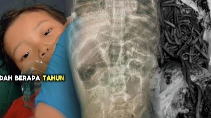 Balita di Bantul Meninggal Akibat Disuntik Penenang dan CT Scan di RSUD