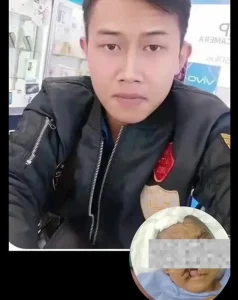 Korban Penyekapan di Bandung Alami Infeksi Parah hingga Muncul Belatung