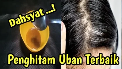 Menghilangkan Uban di Kepala Tanpa Dicabut atau Dicat