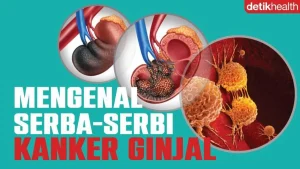YPKI Ajak Pegawai RRI Waspadai Risiko Kanker
